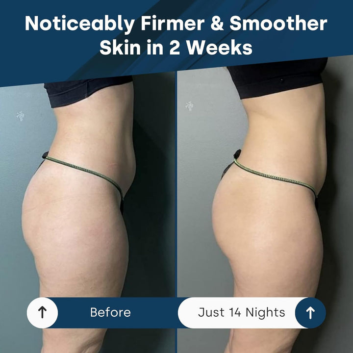 Seaweed anti Cellulite Mud-Based Night Cream for Legs & Thighs with Dead Sea Salt & Vitamin E - Antioxidant Nighttime Body Slimming, Sculpting & Skin Firming Treatment - 500 Ml Cellulite Remover