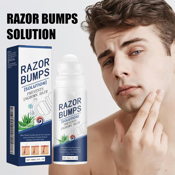 Razor Bumps Treatment for Women and Men, after Shave Solution Roll-On for Ingrown Hairs, Razor Bump Treatment for Face,Neck, Legs, and Underarm Area, Ingrown Hair Serumazor，Smooth Skin(90Ml)