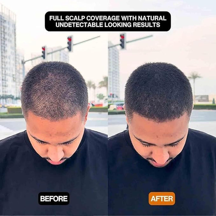 Hairbear Hair Filler,Hair Filler Powder,Long Lasting Water Proof,Fast & Full Care,Natural Hair Thickening Fibers Instant Volume & Scalp Coverage (2Pcs-Black, 39 G (Pack of 1))