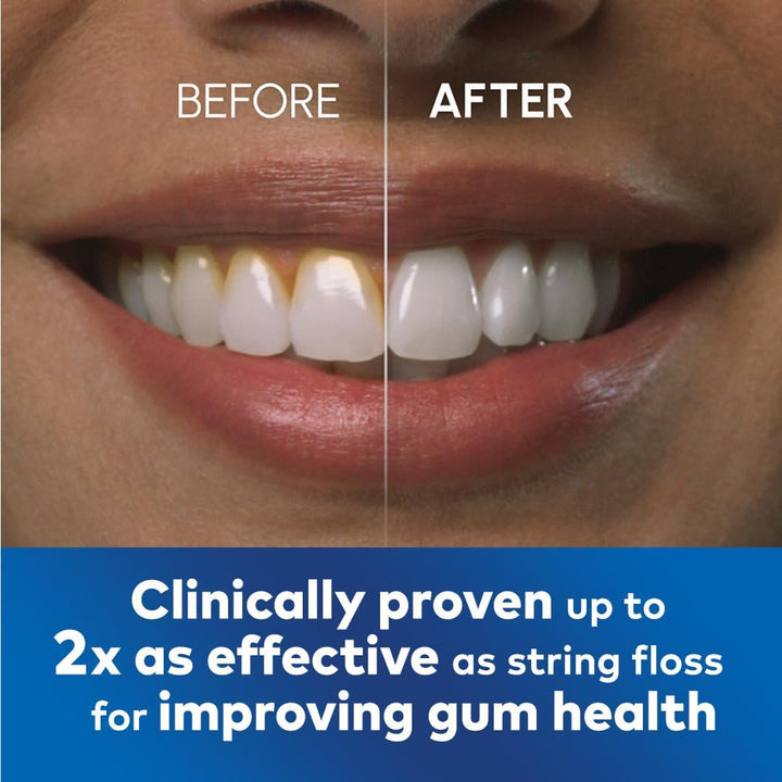 Pulse Water Flosser Cordless, Oral Health Foundation Approved, Water Flosser and Plaque Remover for Teeth, 2 X Water Floss Pressure Settings, 45 Seconds of Flossing, 2 X Tips Included