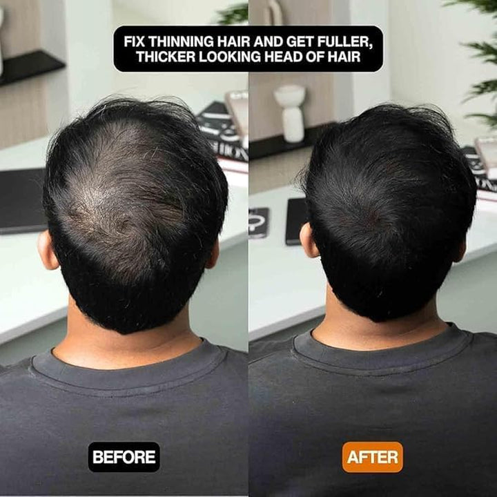 Hairbear Hair Filler,Hair Filler Powder,Long Lasting Water Proof,Fast & Full Care,Natural Hair Thickening Fibers Instant Volume & Scalp Coverage (2Pcs-Black, 39 G (Pack of 1))