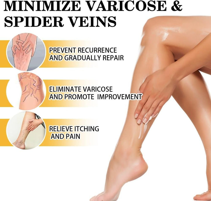 Varic/Ose Ve/Ins Treatment for Legs,Natural Varic/Ose Ve/Ins Cream,Varic/Ose Ve/Ins Treatment Cream,Cream for Varic/Ose Ve/Ins in Legs,Spi/Der V/Eins Repair Cream,Varic/Ose Ve/Ins Relief Cream