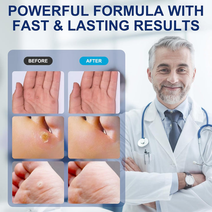 Liquid for Corn Removers, Corn Removers for Feet Extra Strength, Fast Acting Foot Corn Remover, Foot Corn Pain Relief, 15ML Liquid with 15PCS Cushions 10PCS Swabs