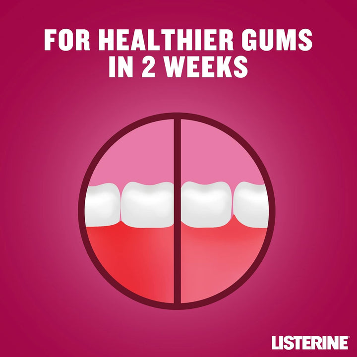 Advanced Defence Gum Treatment Mouthwash (500Ml), Clinically Proven to Treat Gum Disease as in Little as Two Weeks, Repels Plaque Germs to Treat and Prevent Gingivitis from Recurring