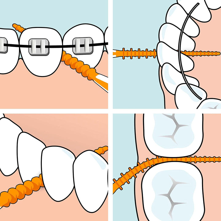 Easypick Toothpicks, Orange, ISO XS-S, 60Pcs, Dental Plaque Removal Tool, Efficient and Easy Cleaning between the Teeth, Toothpicks for Narrow Gaps