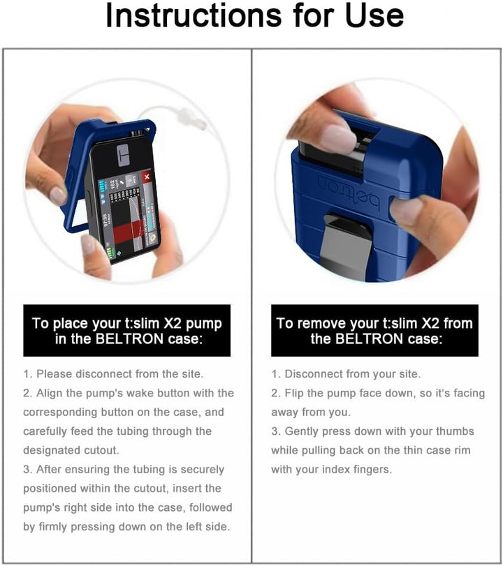 Protective Case for Tandem T:Slim X2 Pump with Built-In Metal Belt Clip (Strong & Durable Case for Tandem Diabetes Care Tslim X2 Insulin Pump) - Blue