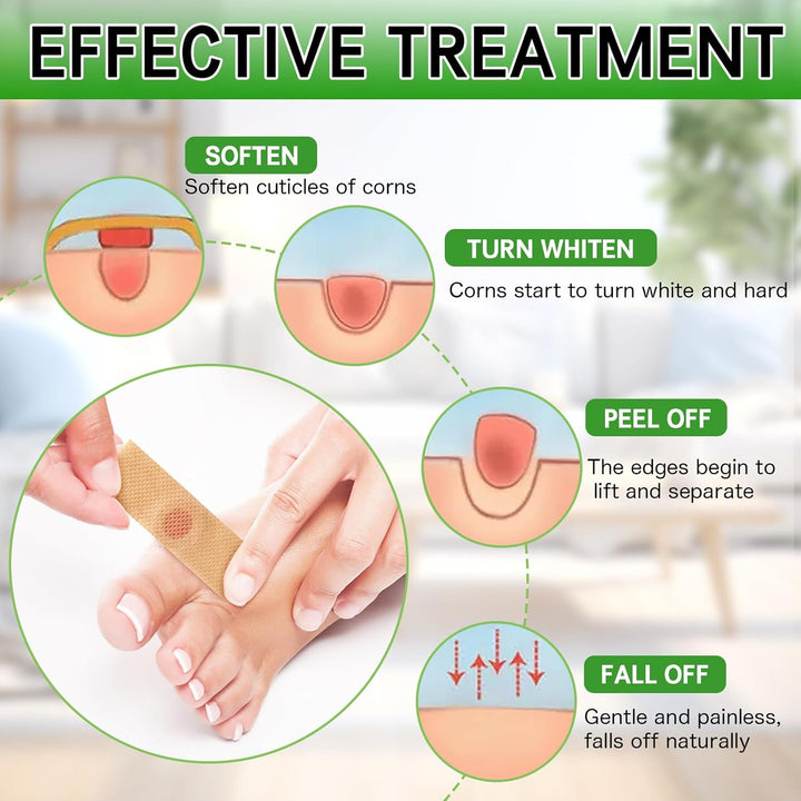 Wart Remover, 30Pcs Verruca Treatment, Plantar Wart Remover for Hands, Feet, Effective Deep Verruca Removal Pads Patches, Pain Relief, Non-Irritating Wart Treatment for Adults