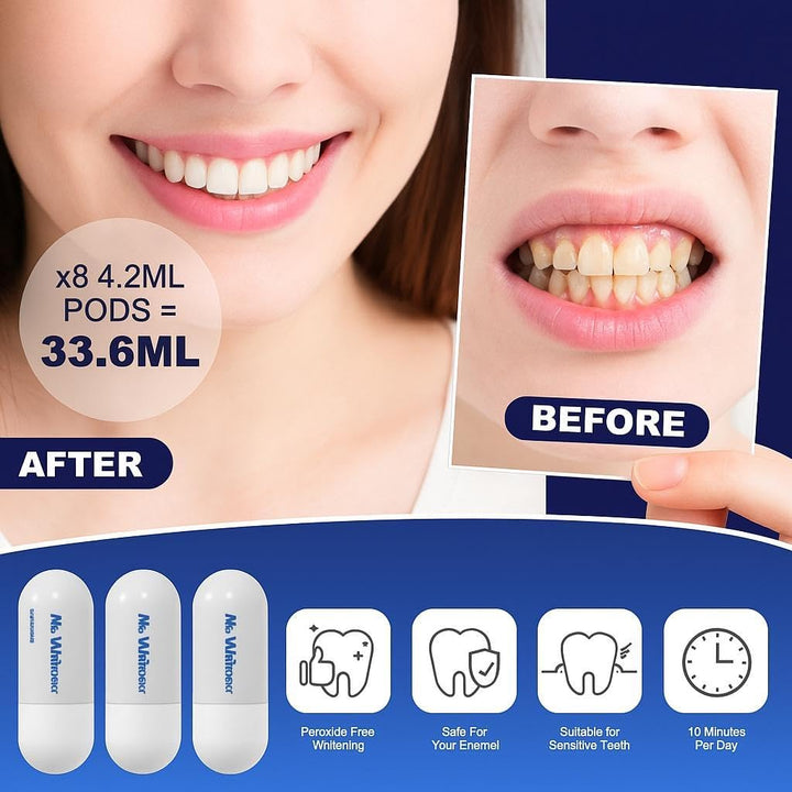 LED Teeth Whitening Kit, Dentists Recommended, Enamel Safe, Professional Pap Tooth Whitener for Sensitive Teeth, Professional 8 Refill Teeth Whitening Gel Pods 33.6Ml, Remove Teeth Stains