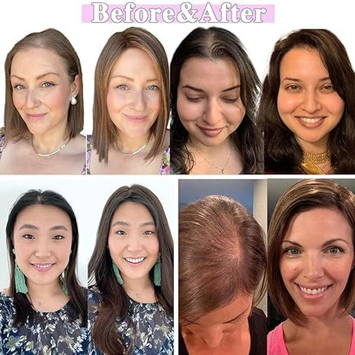 Hair Toppers with Thinninghair 100% Real Human Hair Topper for Women 10Inch Medium Brown Mix Blonde with Dark Brown Root Toppers 120% Density Top Toppee for Thinninghair4T427