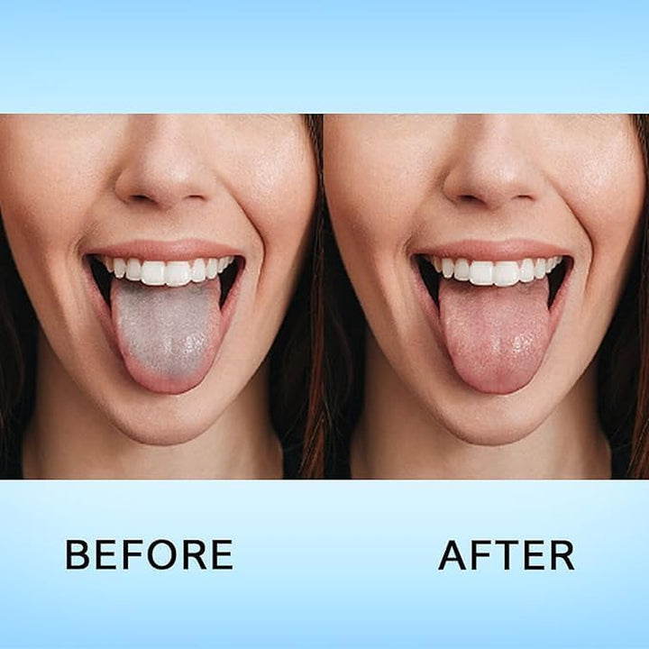 | Pack of 2 Tongue Scrapers, 1X U Shape & 1X Y Shaped 100% Stainless Steel Metal Scraper, for Oral Hygiene and Fresh Breath | Easy to Use Cleaner for Adults