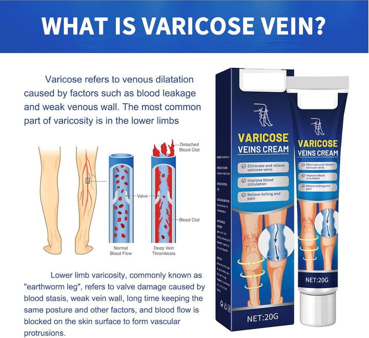 Leg Varicose Ointment,Varicose Vein Gel,Varicose Vein Removal Cream,Vein Relief Cream for Pain Relief, Natural Varicose,20G
