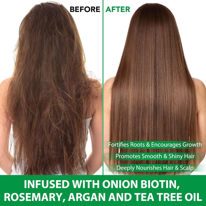 Batana Herbal Hair Growth Shampoo & Conditioner Set - Thinning Hair & Hair Loss Treatment for Women & Men, Thickening Product