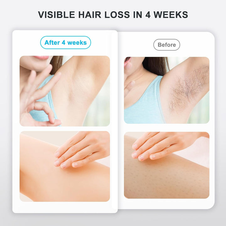 IPL Hair Removal Devices,  Laser Hair Removal Device 999.999 Flashes for Women/Men, up to 1200NM Wavelength, Two Mode, High Energy Levels Painless Laser Hair Removal for Whole Body (White)