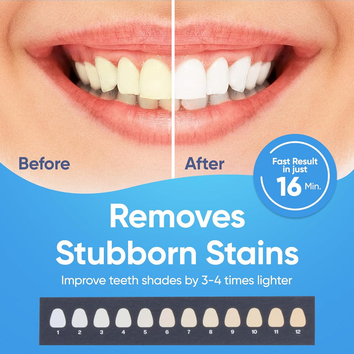 LED Teeth Whitening Kit with 4 Gel Syringes & Case | Formulated by Dentists | Professional Tooth Whitening for Sensitive Teeth | Enamel-Safe and Clinically Tested