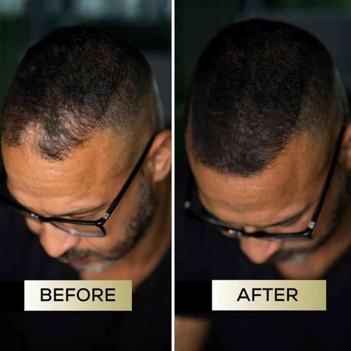 Hair Care Concealer, Women'S Hair Concealer, Create Volumizing Hair, Suitable for Men and Women, Natural and Long-Lasting