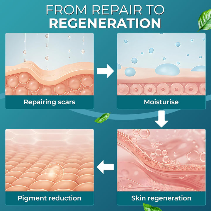 Medical Grade Silicone Scar Tape | 4Cm X 1.2M | Silicone Scar Sheets for after Surgery C Section Recovery, Wrinkles Removal, Face Treatment Gel Patches/Plasters