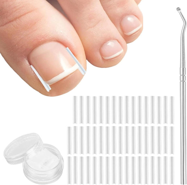 (50+1) Pcs Ingrown Toenail Tool Kit - Corrector with Lifter & Straightener Strips, Pain-Free Treatment for In-Grown Toe Nails, Easy Fixed Toenail Correction Tool.