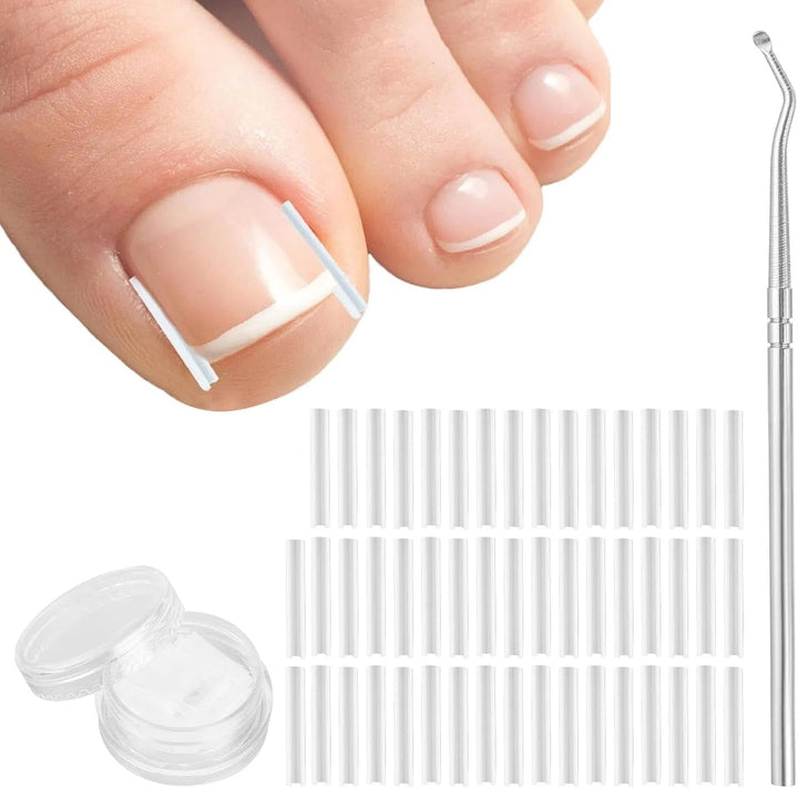 (50+1) Pcs Ingrown Toenail Tool Kit - Corrector with Lifter & Straightener Strips, Pain-Free Treatment for In-Grown Toe Nails, Easy Fixed Toenail Correction Tool.