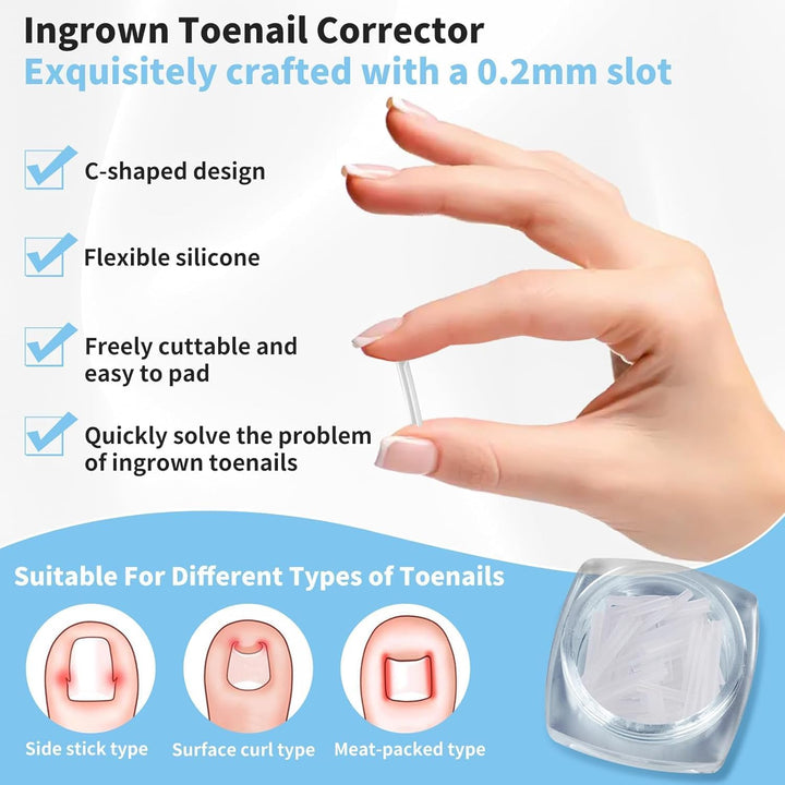 Ingrown Toenail Set - 60 Pcs Pain-Free Straightener Strips -Toe Lifter and Small Scissors- Easy Use Ingrown Toenail Set(Sliver)