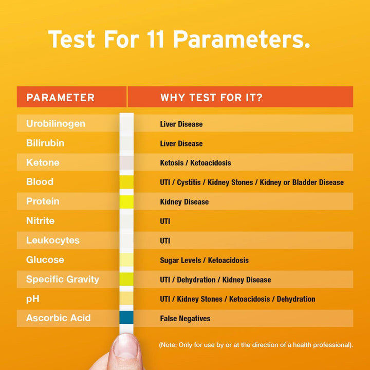 100 X AYDMED 11-In-1 Urine Test Strips | 11 Parameter Urine Test Strips for Urobilinogen, Bilirubin, Ketone, Blood, Protein, Nitrite, Leukocytes, Glucose, Specific Gravity, Ph & Ascorbic Acid