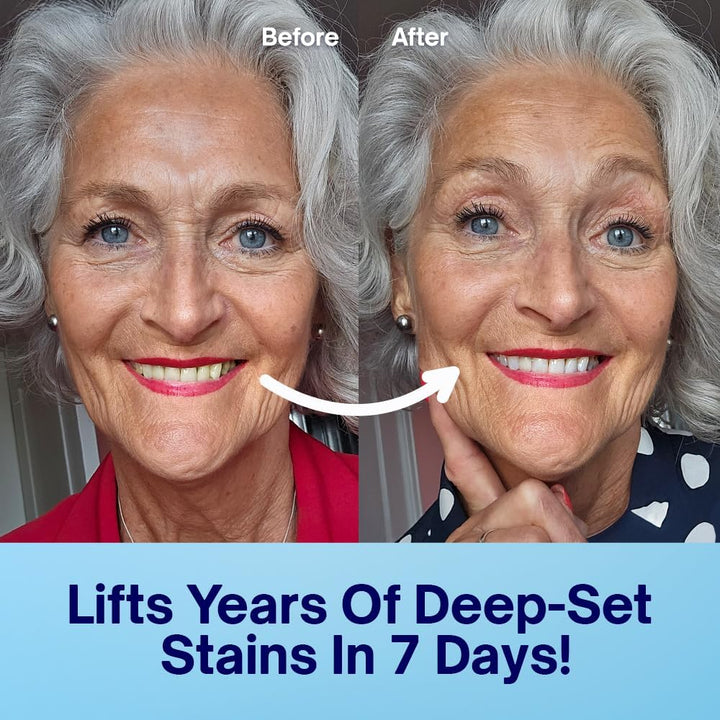 Pap Teeth Whitening Strips - Enamel-Safe, Sensitivity-Free Formula - 42 Peroxide-Free Whitening Strips - Dentist-Approved - Indybest Award-Winning Brand - 21 Treatments - Mint Flavour