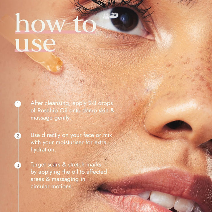 Organic Rosehip Seed Oil 100 Ml | Min Vitamin E 18.3 Mcg/G | Fresh-Pressed | Best for Scars, Fine Lines & Stretch Marks | Ethical & Vegan Society Approved | Manufactured in the UK