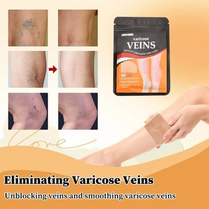 12Pcs Varicose Veins Treatment for Legs, Spider Veins Removal for Legs Treatment Patch, Varicose Veins Patchrelief Leg Pain Strengthen Capillary Health & Improve Blood Circulation