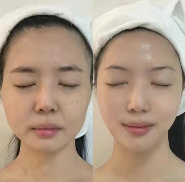 7D HIFU Portable Face & Body Lifting Device + 7 Cartridges – Skin Tightening, Wrinkle Reduction, Anti-Ageing