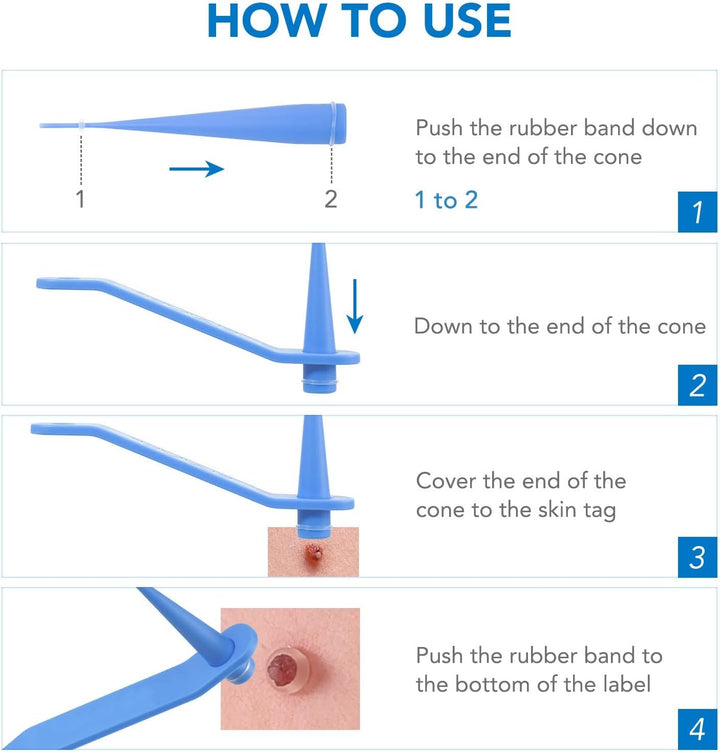 Skin Tag Remover, Skin Tags & Moles Remover Kit, Skin Mole Tag Remover Set Easy Remove Small to Large (2Mm-8Mm)