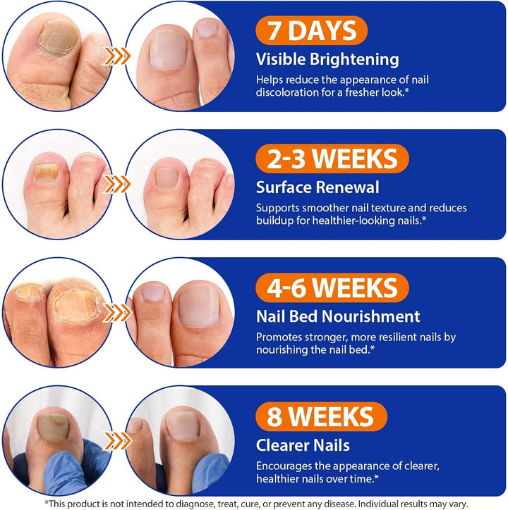 Fungal Nail Patches, 32Pcs Toe Nail Fungal Treatment Pads, 8-Hour Nighttime Toenail Fungus Treatment Restores Healthy Appearance, Reduces Discoloration & Thickness, Overnight Repair for Damaged Nails