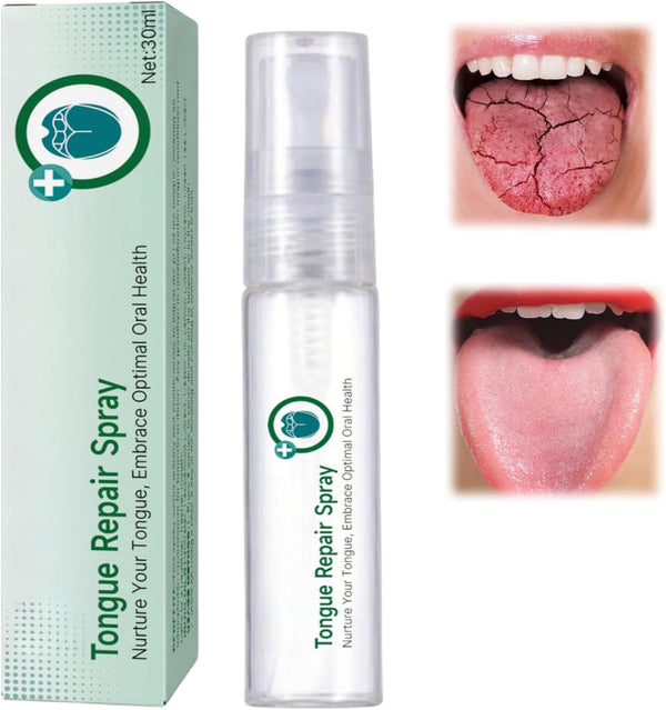 Tongue Repair Spray,Moisturizing Dry Mouth Spray,Fissured Tongue Relief Spray,Instant Dry Mouth Relief,Breath Freshener Spray for Tongue Relief,Tongue Relief Treatment,For White Coating/Bad Breath
