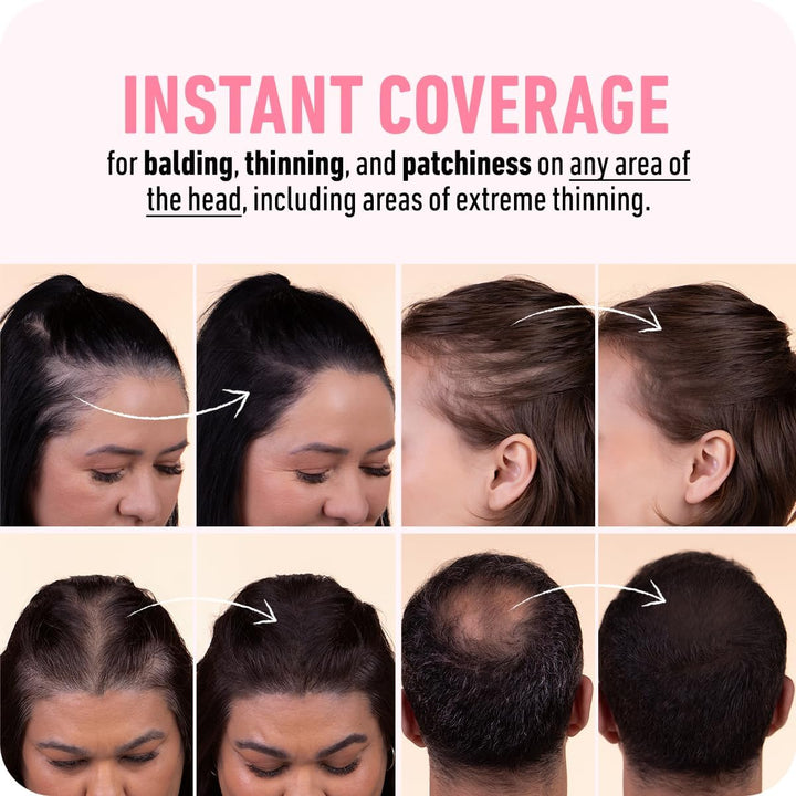 Hairline Powder - Root Touch up Hair Color for Gray Coverage - Bald Spot Concealing Hair Powder for Women and Men - 24-Hour Stain-Proof - Dark Brown