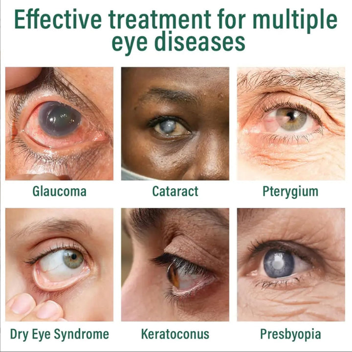 Nano Eye Drops Essence, a Dry Eyes Lubricant Made with Natural Ingredients, Is Suitable for All Eye Strain and Relieves Eyes Fatigue