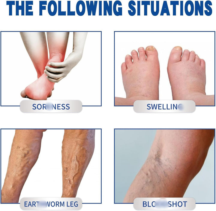 Bee Venom Varicos/E Ve/Ins Treatment for Legs,Varico/Se Relief Vein/S Cream,Varicos/E Vein/S Treatment Cream,Spider Vei/Ns Repair Crea/M,Tired and Heavy Legs Relief,Non-Greasy,Fast-Absorbing