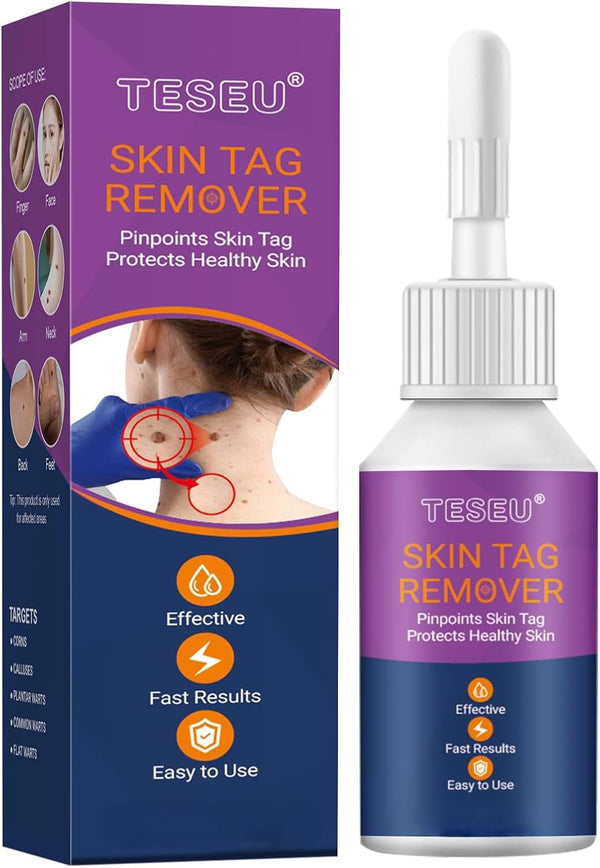 Wart Remover, Wart Removal, Verruca Remover, Fast Effective Skin Tag Removal for Common Warts, Plantar Warts, Corn and Calluse, Suitable for All Body