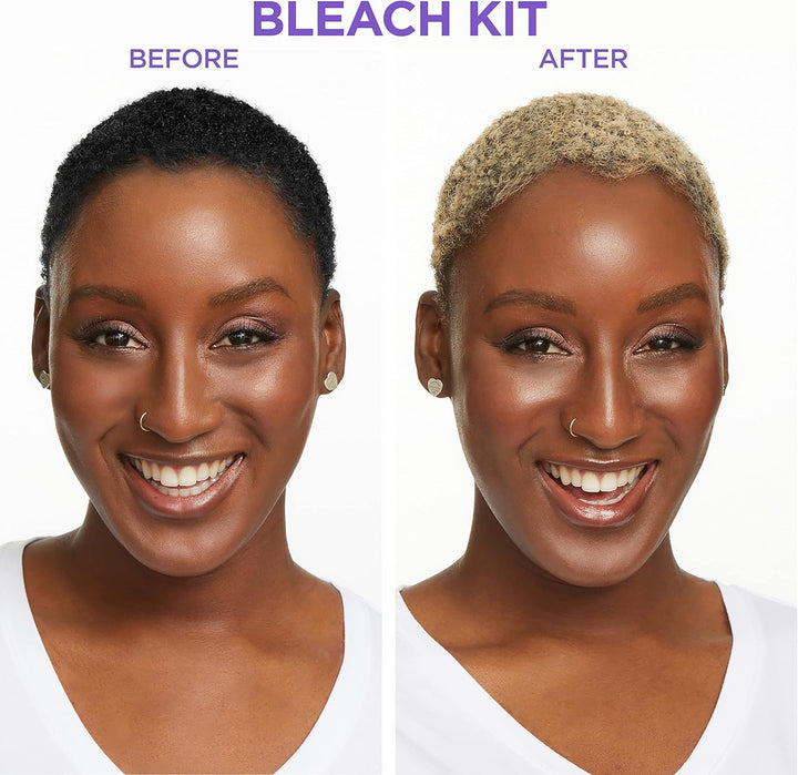 - Carson Dark and Lovely Uplift Hair Bleaching Kit for Dark Hair, Bleach Blonde Hair Dye Kit Includes Hair Bleach Powder, Cream Developer and Hair Toner, Bleach Blonde, 1 Kit