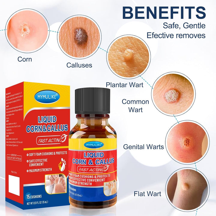 Liquid for Corn Removers, Corn Removers for Feet Extra Strength, Fast Acting Foot Corn Remover, Foot Corn Pain Relief, 15ML Liquid with 15PCS Cushions 10PCS Swabs