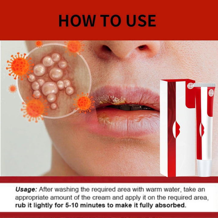 Cold Sore Cream,Gentle Cold Sore Treatment Cream,Mouth Ulcer Treatment for Adults,Gentle Sore Lips Treatment,Mouth Sore Treatment for Women and Men,Mouth Ulcer Gel,Pain Relief,Natural Ingredients