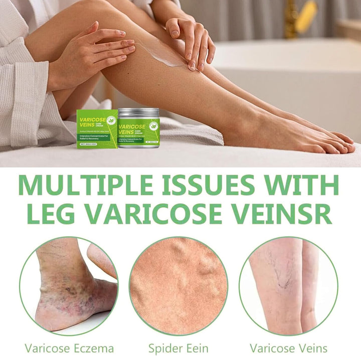 Vari/Cose Veins Cream for Legs - Vari/Cose Veins Leg Care Cream with Vitamin E & Aloe - Reduces Leg Discomfort - Fast-Absorbing, Non-Greasy - 60G