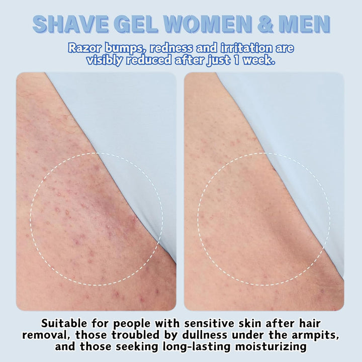 2Pcs Razor Bump Smoothing Solution Ingrown Hair Treatment with BHA AHA - High Roller Ingrown Tonic for Underarms Abdomen - Ingrown Hair Serum for Men & Women - Roller Ball Applicator for Tend Skin