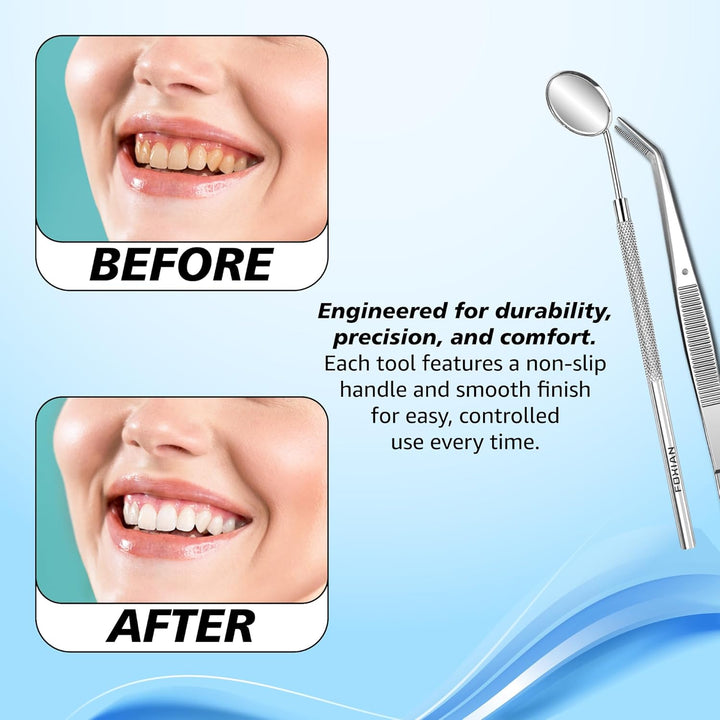 Professional 5 Pcs Oral Plaque Remover for Teeth Stainless Steel Tooth Picks Tartar Cleaner for Teeth Whitening & Oral Care Kit for Men Women Pets (5 Pcs)