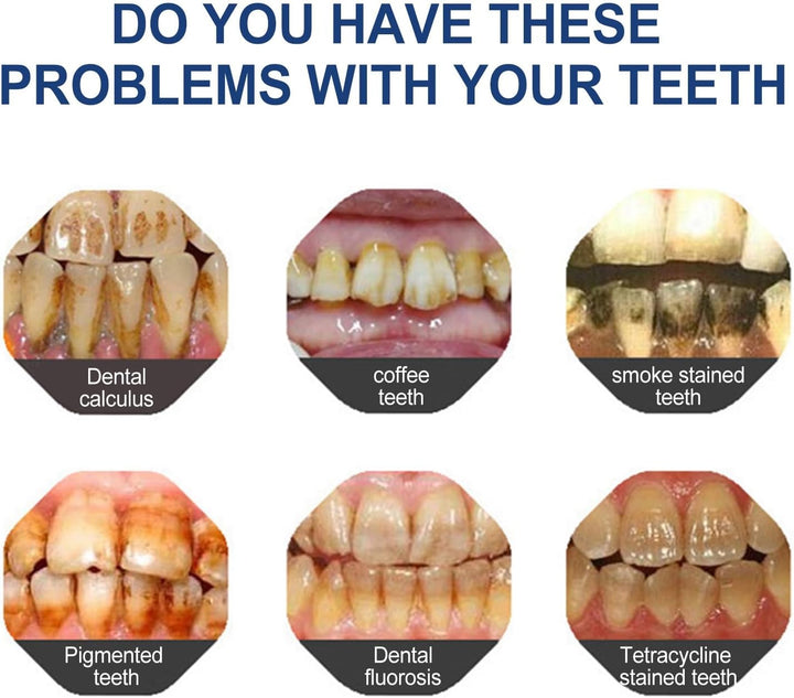 Professional Tooth Paint and Whitening Pen with Strips - Instant Teeth Whitening Essence and Enamel