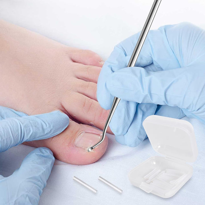 40 Pcs Ingrown Toenail Correction Strips, Toenail Straightener Strips, with Toenail Lifter, Ingrown Toenail Treatment Kit, Toenail Recover Clips, for Women Men Foot Care