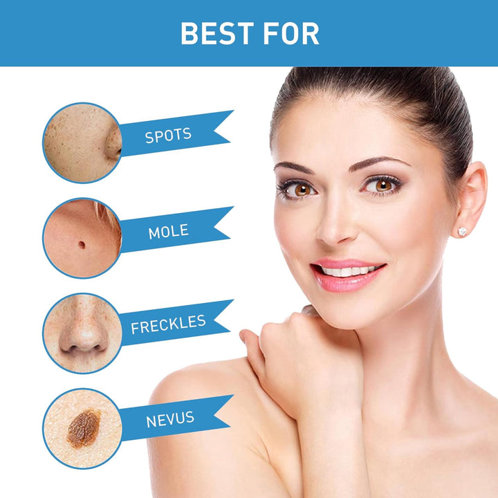 Wart Remover Cream for Body and Hands, Suitable for Common Warts, Flat Warts - 20G (1)