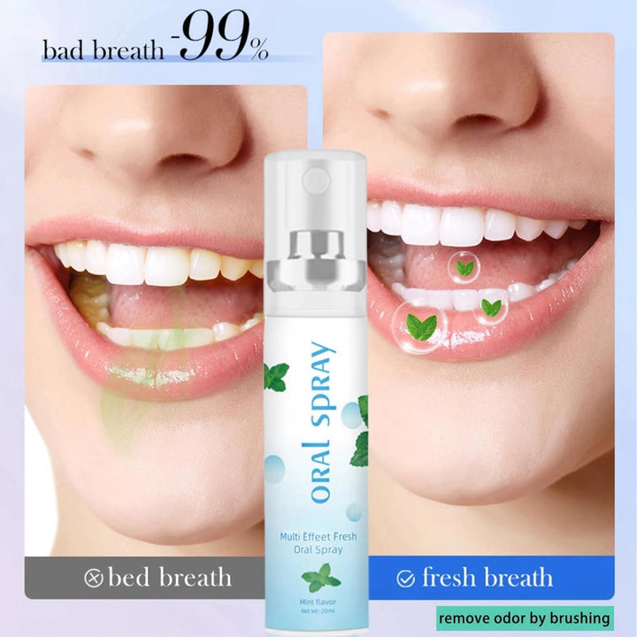 Dry Mouth Flavoured Spray,Breath Freshener Spray,Oral Care Spra/Y,Fresh Breath S/Pray,Mouth Spr/Ay,Dry Mo/Uth Relief,Brea/Th Freshener,D/Ry Mo/Uth Spr/Ay,Bre/Ath Sp/Ray for Bad Bre/Ath(Mint Flavor)