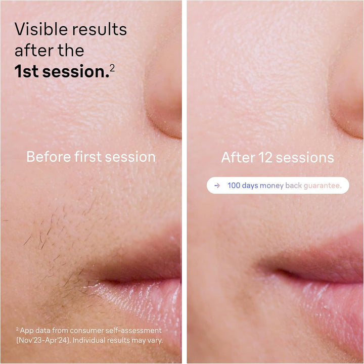 Smart IPL Skin I Expert, at Home Hair Removal, Alternative for Laser Hair Removal, Smart IPL with Exclusive Free App, Mini Face Shaver, 3 Heads, 2 Years of Smooth Skin, PL7249