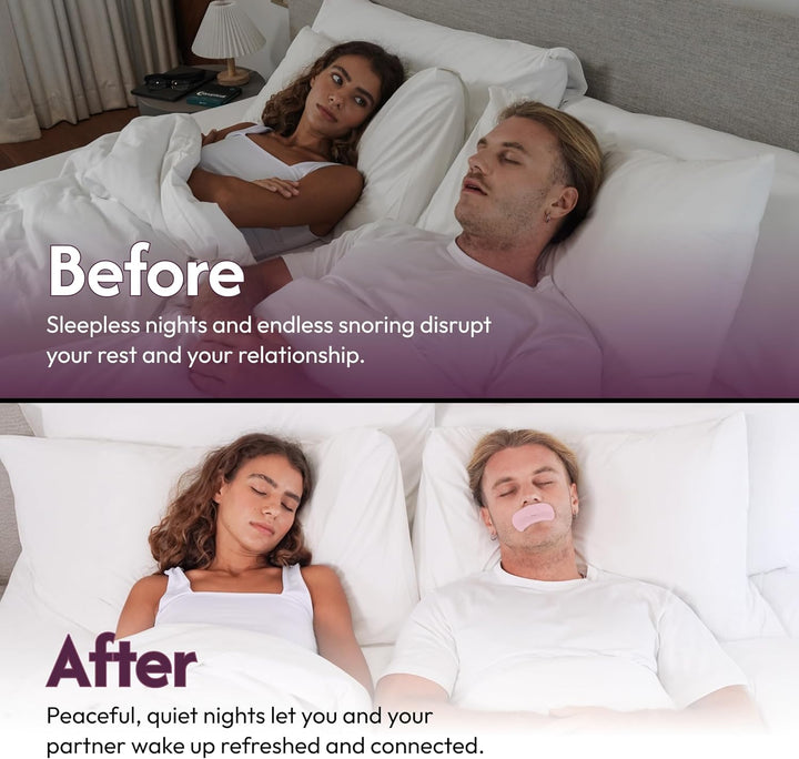 Sleepseal Mouth Tape for Sleeping - Made from Sustainable Bamboo Silk, Hypoallergenic & Dermatologically Tested Sleep Tape – Snoring Aid Solution, Improves Nasal Breathing – 30 Night Supply