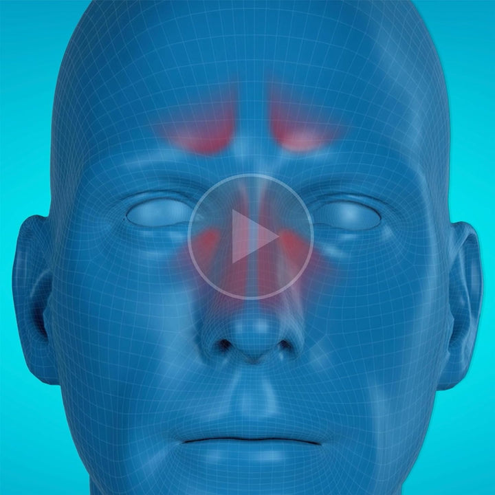 Blocked Nose Nasal Spray 15Ml, Congestion Relief That Gets to Work in 2 Minutes and Lasts for up to 10 Hours