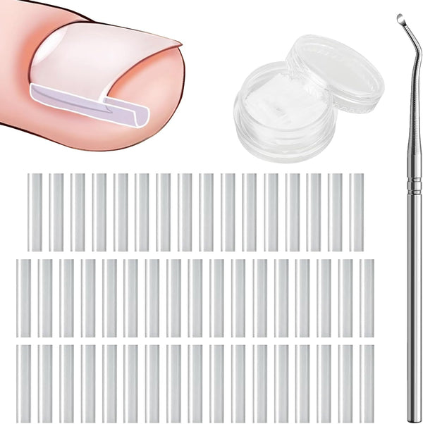 Ingrown Toenail Corrector Set - 50 PCS Pain-Free Toenail Straightener Strips with Toenail Lifter - Easy Use Ingrown Toenail Tools Kit