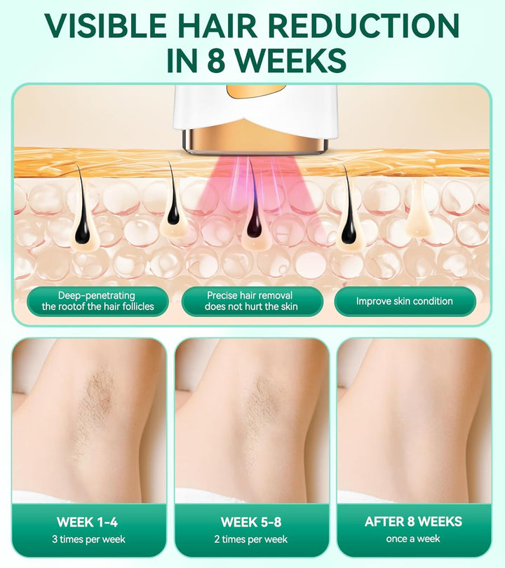 IPL Laser Hair Removal Device with Cooling System, Upgraded 3 Functions Hair Removal Device, 999,900 Flashes, Painless Hair Removal Device for Women Men Bikini Line Armpits Full-Body Hair Removal